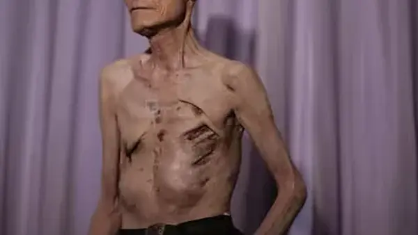 Sobrevivió a dos bombas atómicas en tres días: la increíble historia del hombre que estuvo en Hiroshima y Nagasaki